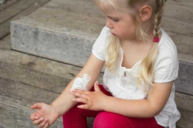 Симптомы и причины крапивницы у детей