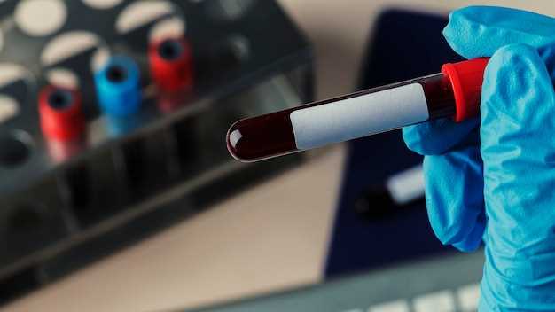 Как сдается гликозилированный гемоглобин: подготовка к анализу