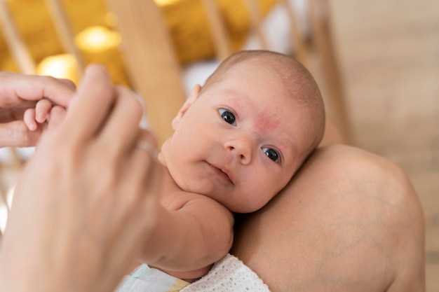 Признаки желтухи у новорожденных: как ее определить и что делать?