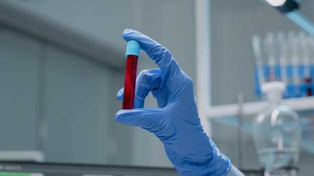 Какие основные показатели измеряются в общем анализе крови из вены
